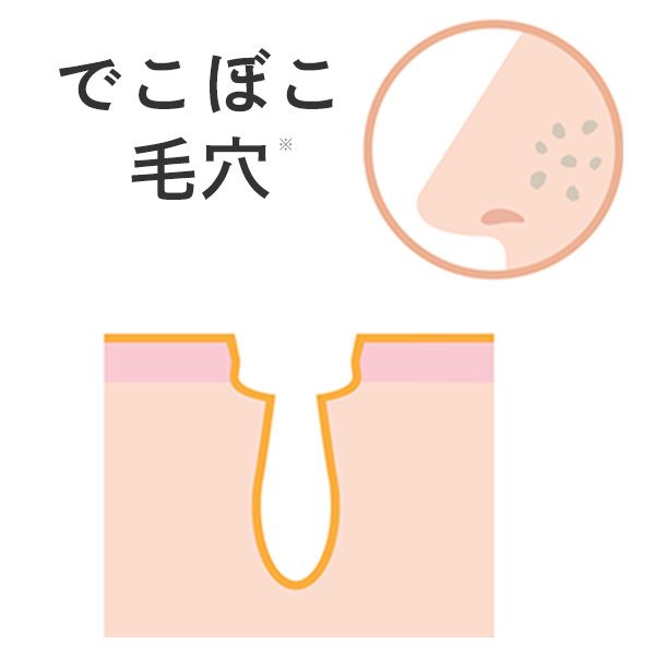 開き毛穴のイメージ