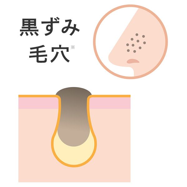 黒ずみ毛穴のイメージ