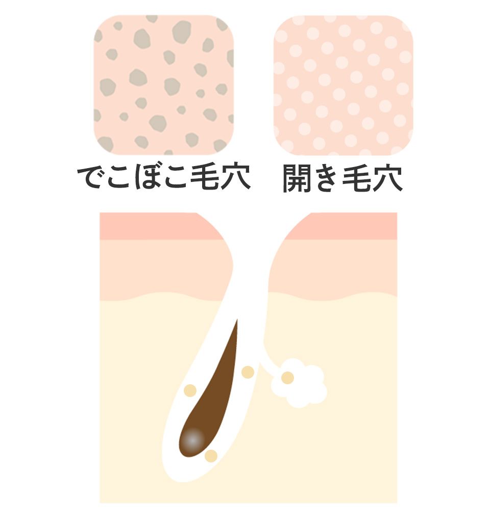 皮脂が少ないときの毛穴のイメージ