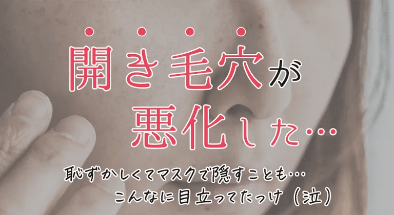 開き毛穴_マスクなし.jpg